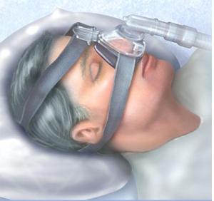 This is why CPAP users are affectionately termed "hose heads." 
